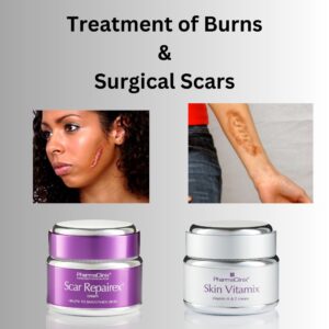 Treatment of Burns and Surgical Scars: Find Relief