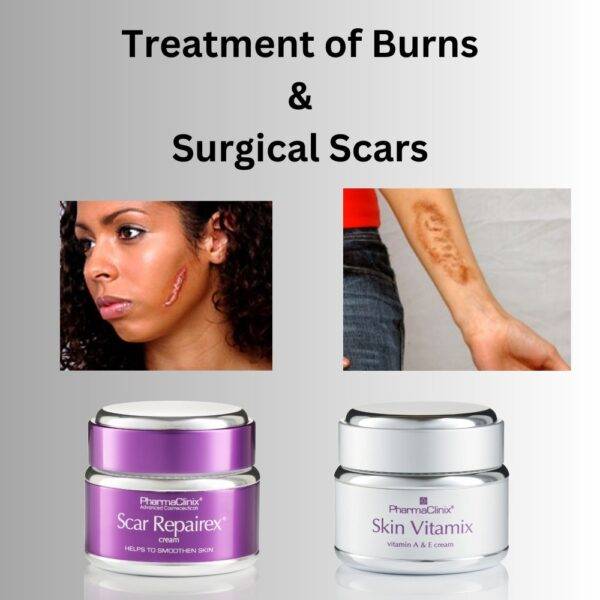 Treatment of Burns and Surgical Scars: Find Relief