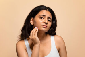 Dark Skin from Eczema